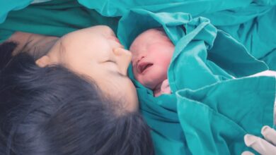 الولادة القيصرية الرئيسية 1536x757