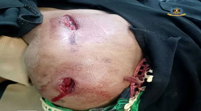 7693ada0 34d9 4aae 9606 2dfc181cd372